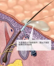 狐臭怎么产生的 如何祛狐臭