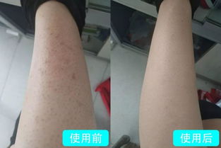 用它洗澡,30秒吸出陈年螨虫,这tm才叫洗干净了,明星网红都在用 皮肤