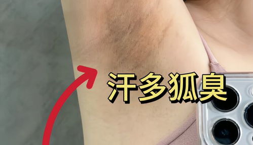 低成本告别狐臭 过来人分享有效止汗去味方法