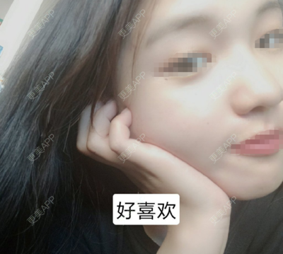告别尴尬，重拾自信 我的深圳腋臭手术全记录